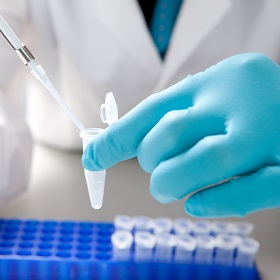 LABORATORY CONSUMABLES & SUPPLIES